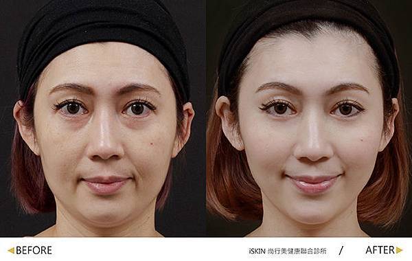 音波doublo-B-A-07 音波doublo-B-A-07