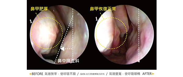 nose-Howe-5 nose-Howe-5