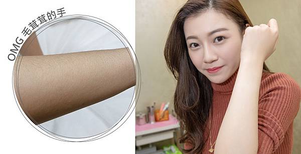 Hair_removal-Youni-2 Hair_removal-Youni-2