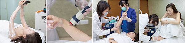 Hair_removal-Youni-3 Hair_removal-Youni-3