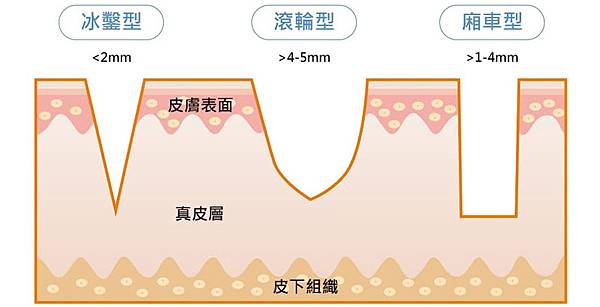 lu-linetoday_pimple-4 lu-linetoday_pimple-4