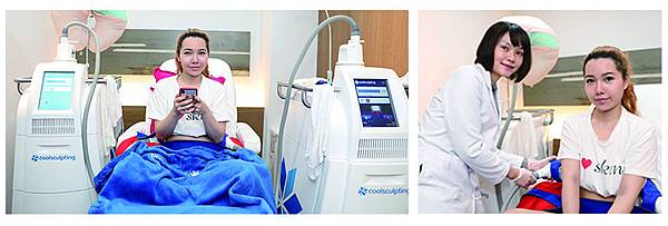 coolsculpting_yang_58 coolsculpting_yang_58