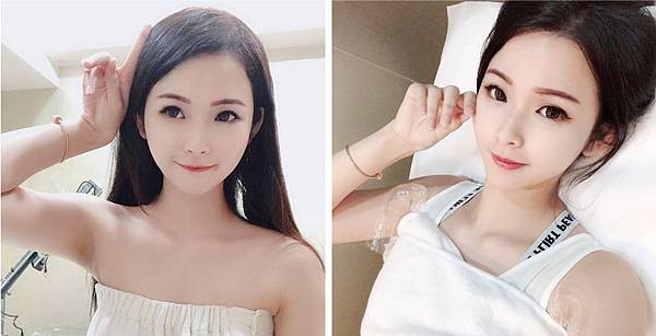 Hair_removal-talise-2 Hair_removal-talise-2