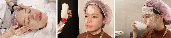 Hyaluronic-MEI-4 Hyaluronic-MEI-4