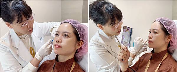 Hyaluronic-MEI-6 Hyaluronic-MEI-6