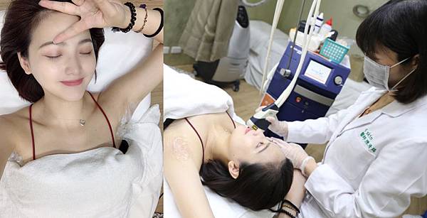 Hair_removal-Erica-3 Hair_removal-Erica-3