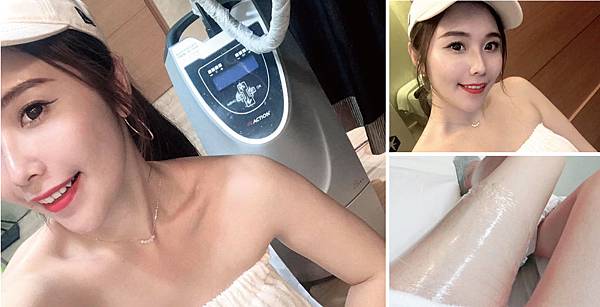 CoolSculpting-Stephy-4 CoolSculpting-Stephy-4