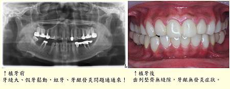 00 比較圖