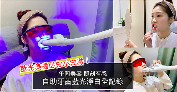 台北牙齒美白推薦.png 台北牙齒美白推薦.png