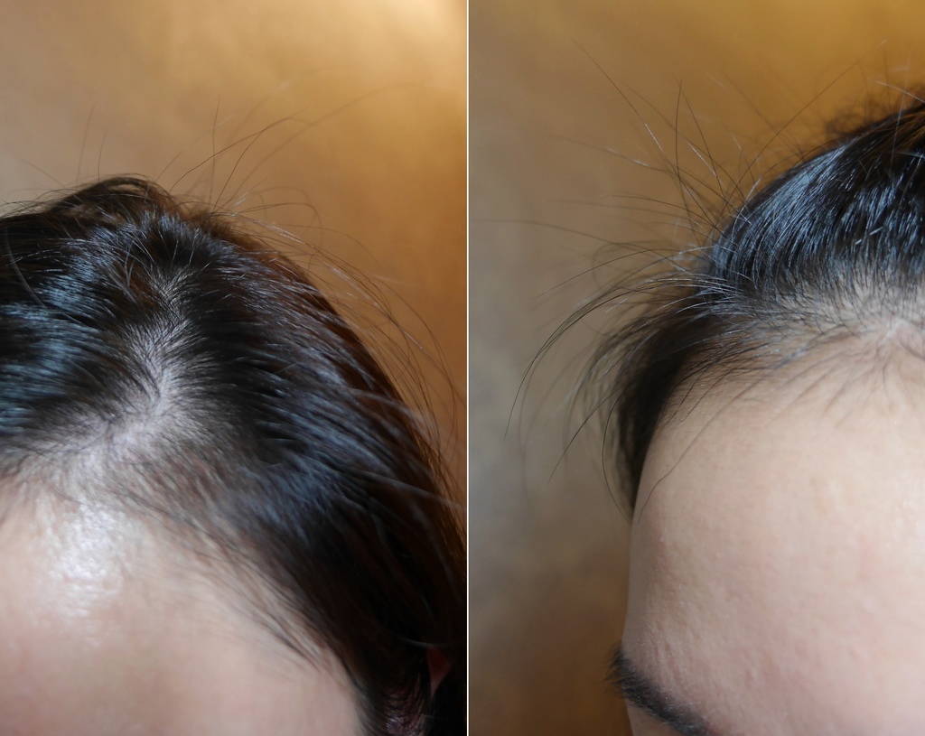 星采星和_DR.CYJ髮胜肽