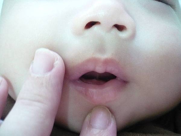 牙1.jpg 牙1.jpg