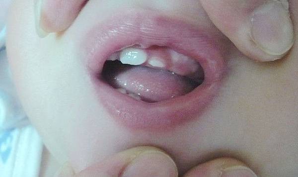 牙5.jpg 牙5.jpg