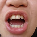 詹惠妹的牙齒.JPG