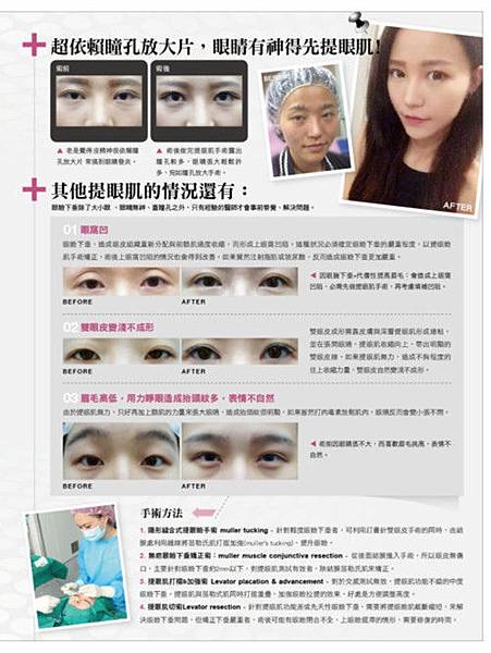 愛惟美-1040624中圖2