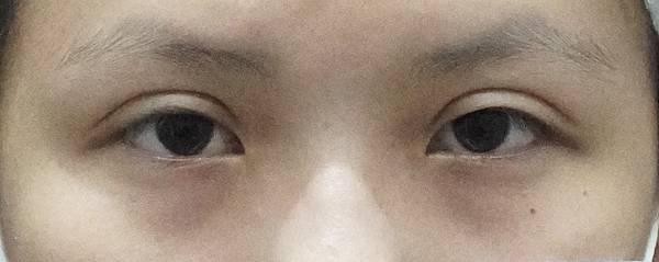 20211027 (術前1).jpg