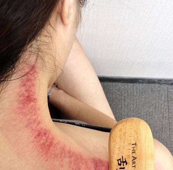 かっさ グアシャ 癒し Life職人的部落格 痞客邦 かっさ グアシャ 癒し Life職人的部落格 痞客邦