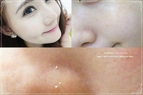 ♥醫美♥ Thera Clean醫洗臉 來幫我深層洗臉,搞定豆花臉、粉刺煩惱肌好簡單!!!