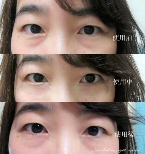 before after.jpg 試用