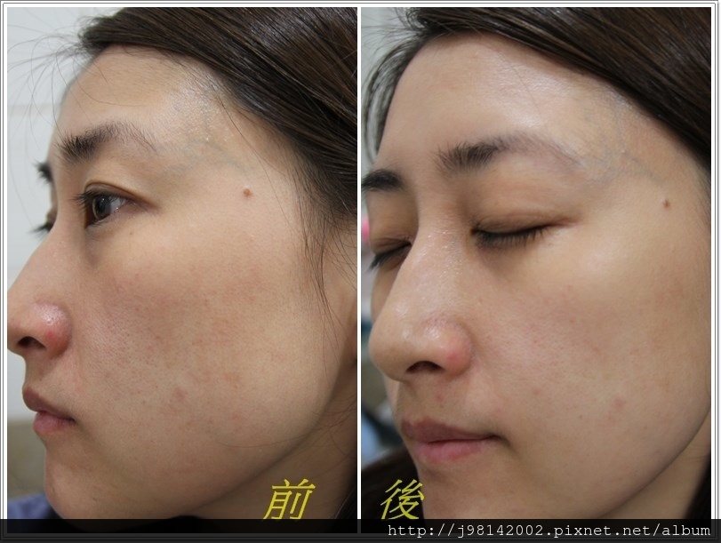 露奇亞4.jpg 試用