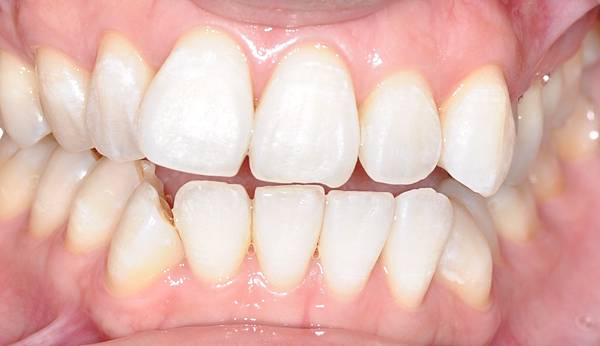 高雄牙醫/左營牙醫/牙醫推薦/高雄植牙