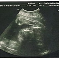 JJ BABY 20111025-001.jpg