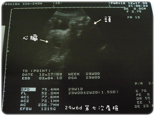 98.12.17 第七次產檢