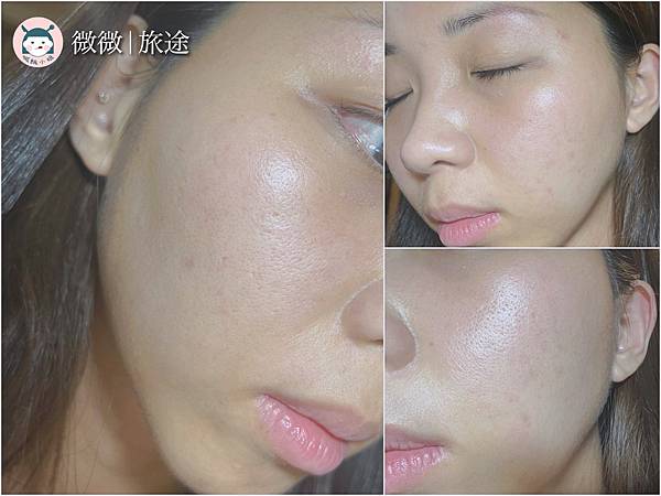 蜂巢皮秒_東區醫美_醫美推薦_愛爾麗忠孝店-2.jpg 蜂巢皮秒_東區醫美_醫美推薦_愛爾麗忠孝店-2.jpg