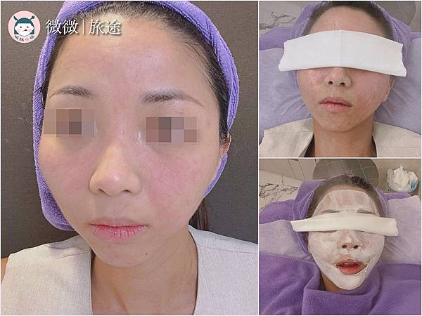 蜂巢皮秒_東區醫美_醫美推薦_愛爾麗忠孝店-6.jpg 蜂巢皮秒_東區醫美_醫美推薦_愛爾麗忠孝店-6.jpg