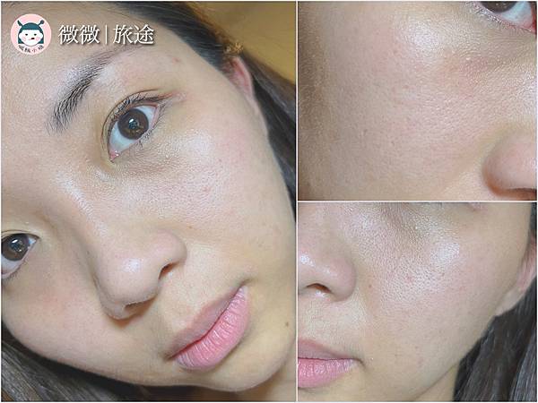 蜂巢皮秒_東區醫美_醫美推薦_愛爾麗忠孝店-8.jpg 蜂巢皮秒_東區醫美_醫美推薦_愛爾麗忠孝店-8.jpg