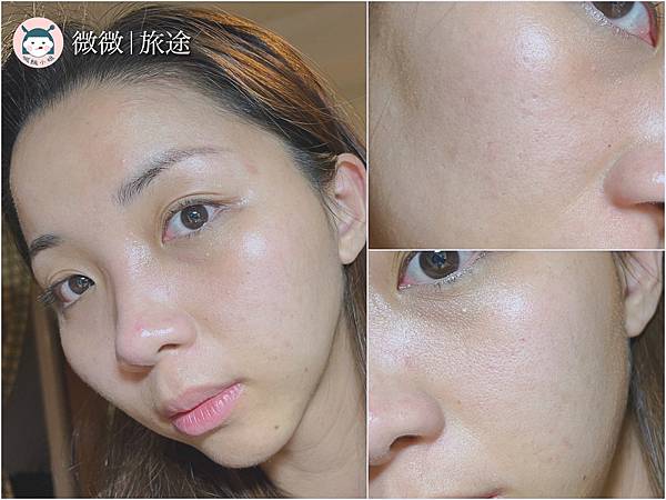 蜂巢皮秒_東區醫美_醫美推薦_愛爾麗忠孝店-7.jpg 蜂巢皮秒_東區醫美_醫美推薦_愛爾麗忠孝店-7.jpg