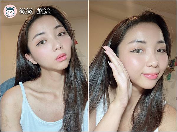 蜂巢皮秒_東區醫美_醫美推薦_愛爾麗忠孝店-10.jpg 蜂巢皮秒_東區醫美_醫美推薦_愛爾麗忠孝店-10.jpg