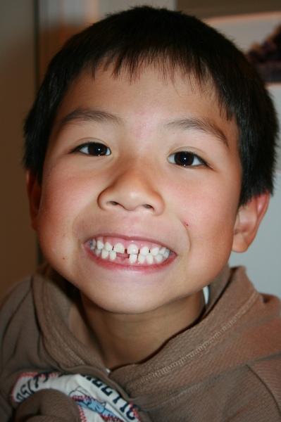 I lost my tooth last night! I lost my tooth last night!