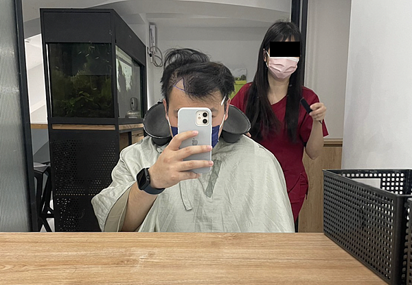 [植髮分享] Part 2 術後篇 手術歷程大公開,經驗