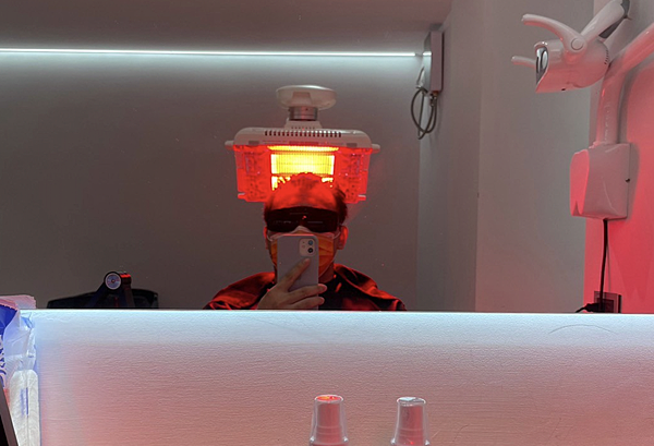 [植髮分享] Part 2 術後篇 手術歷程大公開,經驗