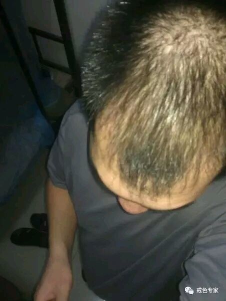 44356659252dd42a1bec4afc0a3b5bb5c8eab89b 44356659252dd42a1bec4afc0a3b5bb5c8eab89b