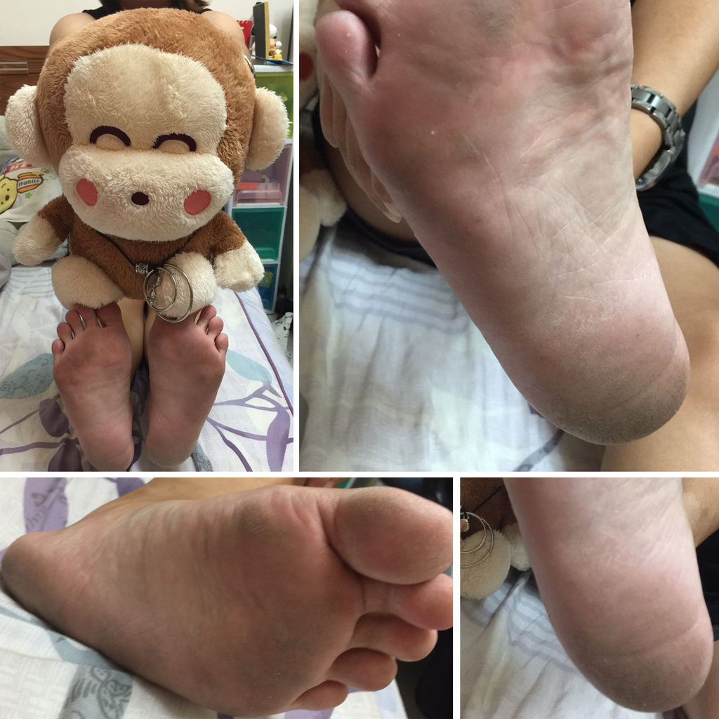 倫敦時尚美學沙龍_保養前.jpg 倫敦時尚美學沙龍_保養前.jpg