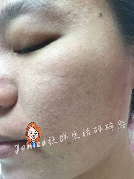 迪芬思-安琪拉精露-金盞花-臉部乾燥2.jpg 迪芬思-安琪拉精露-金盞花-臉部乾燥2.jpg
