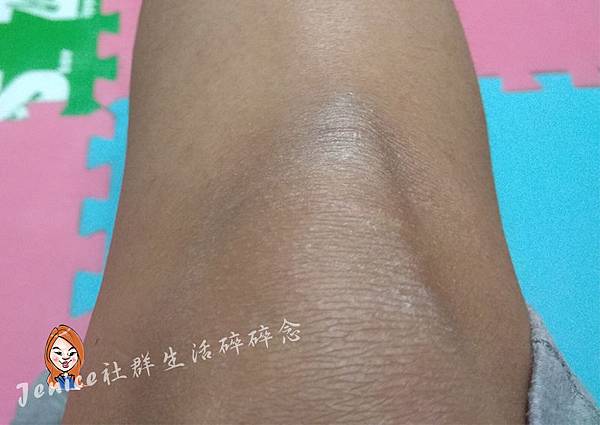 20180323EN%5CR燕窩複方滋養液_使用前膝蓋.jpg 20180323EN%5CR燕窩複方滋養液_使用前膝蓋.jpg