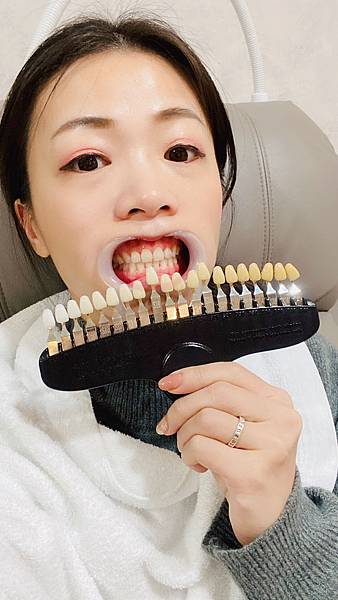 snow capped牙齒美白 (4).jpg snow capped牙齒美白 (4).jpg