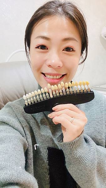 snow capped牙齒美白 (3).jpg snow capped牙齒美白 (3).jpg