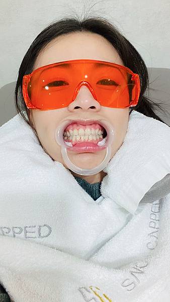 snow capped牙齒美白 (7).jpg snow capped牙齒美白 (7).jpg