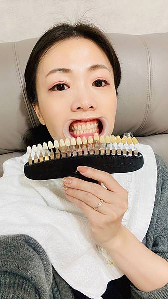 snow capped牙齒美白 (11).jpg snow capped牙齒美白 (11).jpg