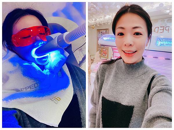 snow capped牙齒美白.jpg snow capped牙齒美白.jpg