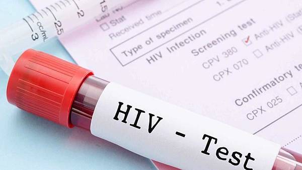 hiv.jpeg