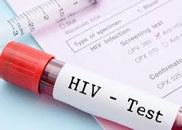 hiv.jpg
