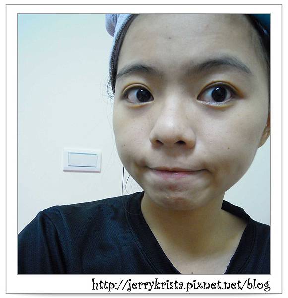 敷後拔粉刺前.jpg