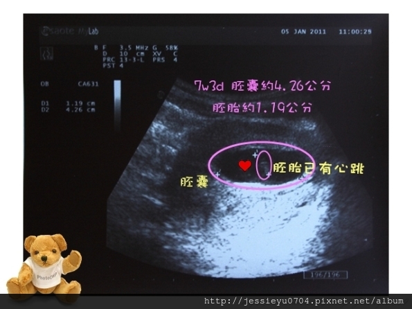 7週 11週 潔西懷孕日記 潔西媽咪的身心美學 痞客邦