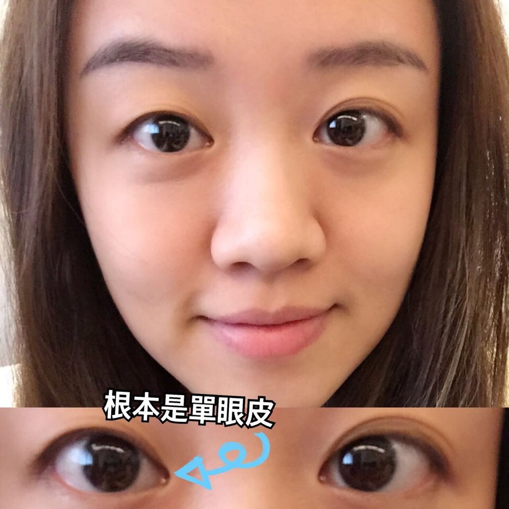 【日本AB】隱形塑眼雙面貼/蝴蝶版(強力)+雙眼皮睡眠記憶貼/蝴蝶版-女孩/男孩的眼皮心機,擺脫無神的大小眼
