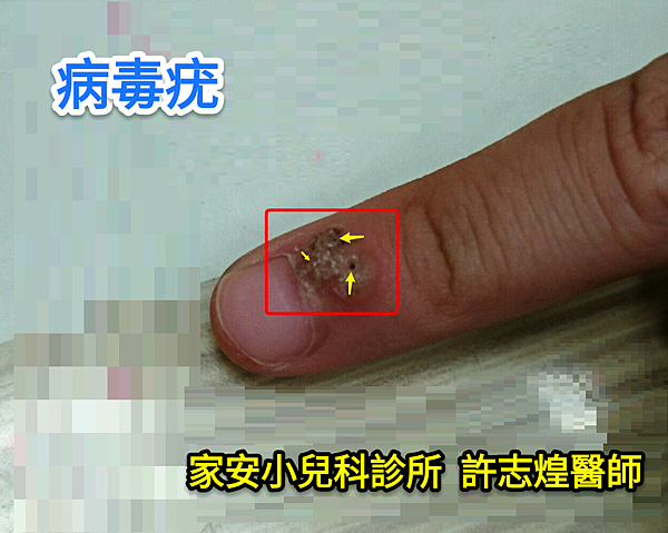 13680058_887779814659440_3472195152090368133_o