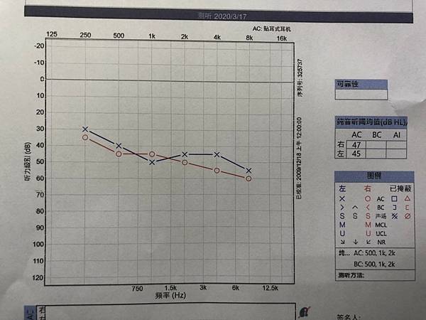 聽力損失必看》2023新【聽力檢查費用價格】注意事項！